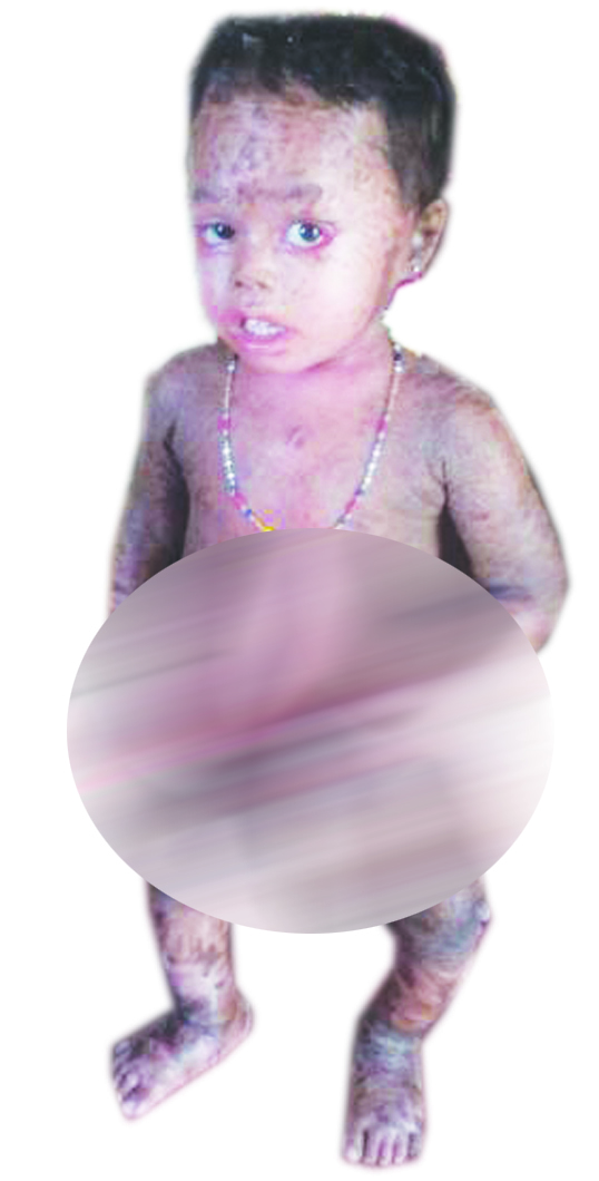 ಈ ಮುಗ್ದ ಮಗುವಿಗೆ ಸಹಾಯ ಮಾಡೋಣವೇ..?